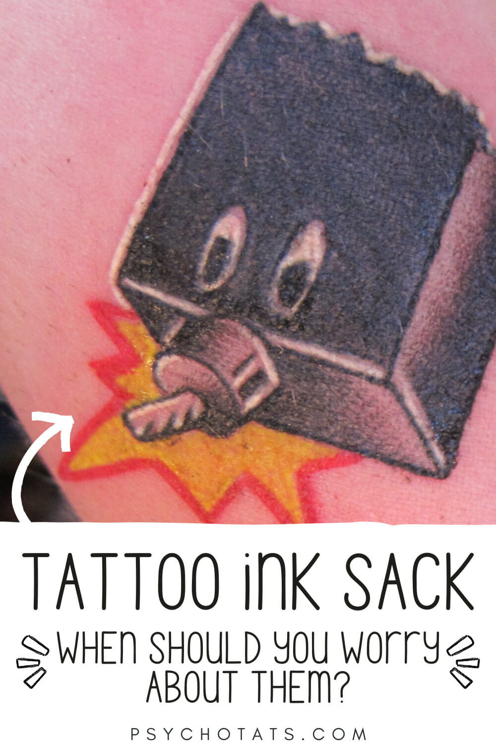 Tattoo Ink Sack When Should You Worry About Them? Psycho Tats